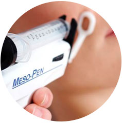 mesotherapie